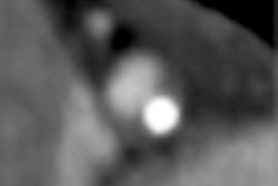 2012 04 19 11 32 29 920 Ebersberger thumb 04 Comp