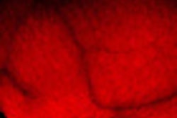 2012 04 19 14 56 51 970 Fda Transillumination Thumb