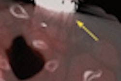 2012 04 26 09 07 36 167 Sarrazin Ied Generator Infection Thumb