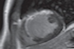 2012 04 26 16 08 52 189 Gadobutrol Image B Thumb