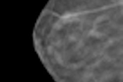 2012 05 02 16 53 16 506 Digital Tomosynthesis Thumb
