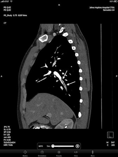 2012 05 04 13 59 14 823 2012 05 08 Ipad2 450