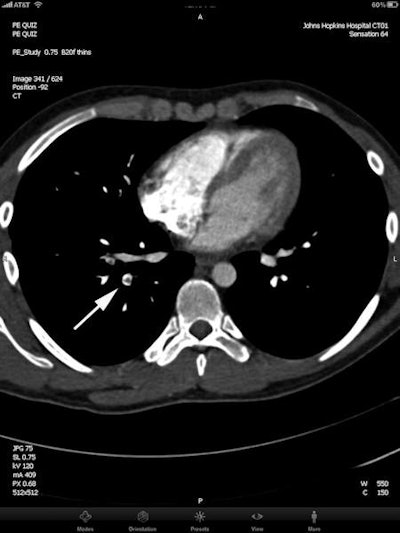 2012 05 04 13 59 15 813 2012 05 08 Ipad1 450