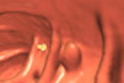 2012 05 14 14 53 02 557 Zalis thumb 05 Comp
