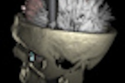 2012 05 17 11 34 41 404 Vanhorn Phineas 70
