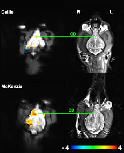 On fMRI, more caudate activity is seen with the reward signal