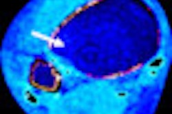 2012 05 18 14 52 40 289 Ankle Ct D Thumb