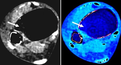 Transaxial images of the right ankle joint