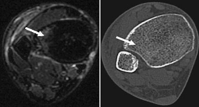 Transaxial images of the right ankle joint