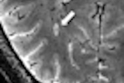 2012 05 23 15 18 07 504 7 T Mri Thumb