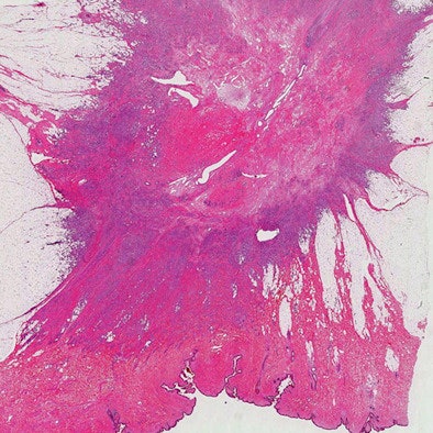 Photomicrograph of histologic specimen