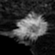 2012 06 01 09 29 12 294 Breast Mri 4 B Thumb