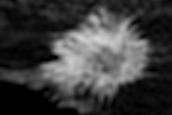 2012 06 01 09 29 12 294 Breast Mri 4 B Thumb