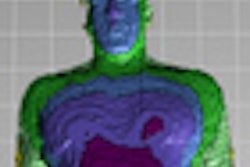 2012 06 09 07 51 58 0 Kinect New Combo Thumbnail