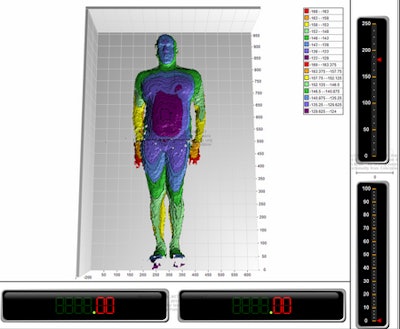 Software developed by Radimetrics registers a depth map and computes a skeletonization of the person, and the data are used to estimate the volume of the individual. Image courtesy of Dr. Gregory Couch, Radimetrics.