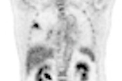 2012 06 13 14 54 26 238 Alessio Thumb