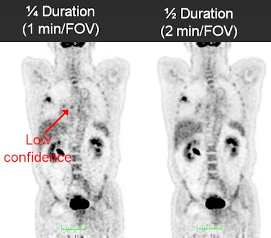 FDG-PET image quality over various time points