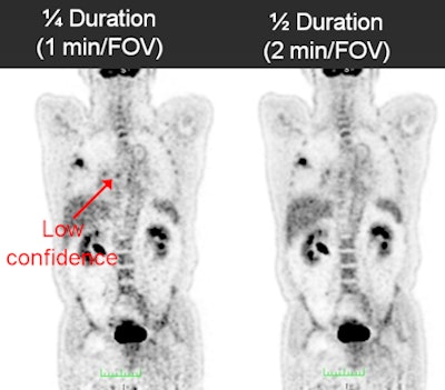 FDG-PET image quality over various time points