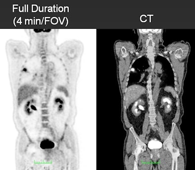 FDG-PET image quality over various time points