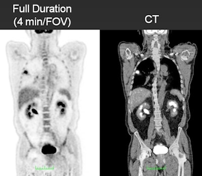 FDG-PET image quality over various time points