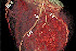 2012 06 14 14 50 01 110 Ross Thumb 70