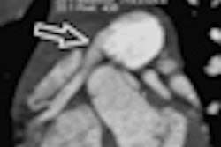 2012 06 19 11 34 57 525 Boy With Arcapa Thumb