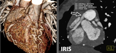 Four-year-old boy with ARCAPA