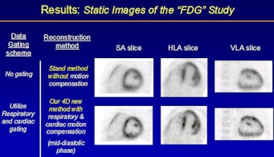 Static images of the FDG study