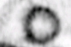 2012 06 26 14 14 50 909 4 Dpet Thumb