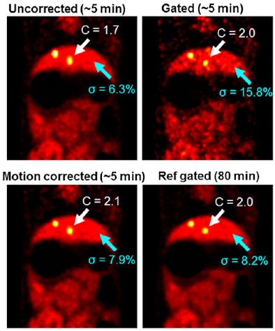 Motion corrected PET images of a rabbit