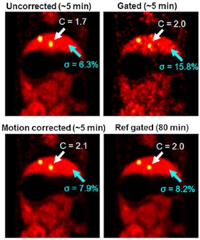 Motion corrected PET images of a rabbit