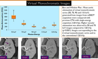 Mean aortic attenuation of virtual monochromatic series
