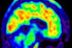 2012 07 11 11 48 51 452 Pet Alzhemier Neurology Thumb