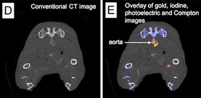 CT image near bifurcation of aorta