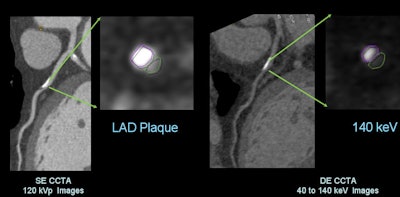 Monochromatic imaging at CCTA