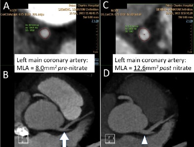 2012 07 26 12 47 50 36 Hamilton fig4