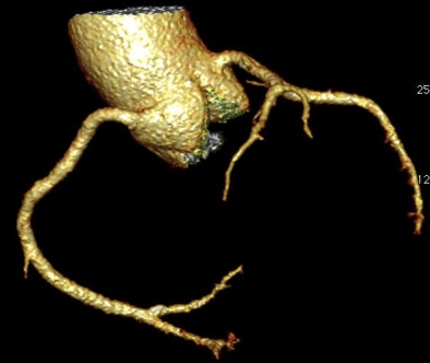 2012 07 26 12 47 51 885 Hamilton fig3b