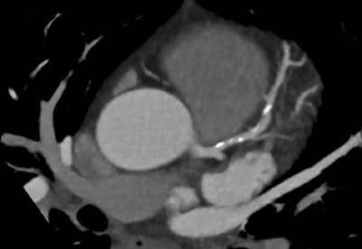 2012 07 26 12 47 52 505 Hamilton fig3a