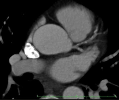 2012 07 26 12 47 53 853 Hamilton fig2