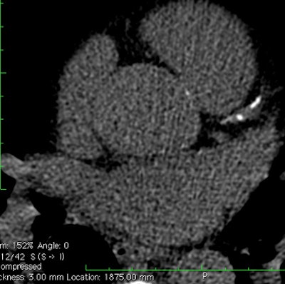 2012 07 26 12 47 55 427 Hamilton fig1