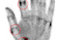 2012 07 30 15 08 32 418 Mhlanga Pem Thumb