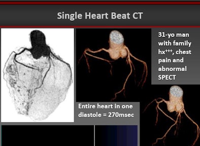 Dual-source CT in 31-year-old
