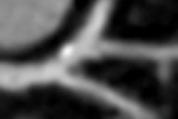 2012 08 06 13 55 31 721 Schoepf thumb 08 70x70