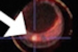 2012 08 07 09 15 00 482 Aurora Pet Mri Image Thumb