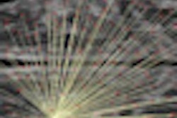 2012 08 08 16 38 34 118 Wustl Brain Image Thumb