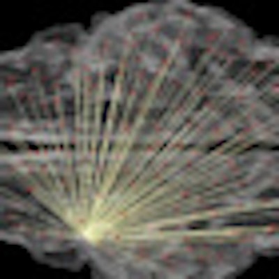 2012 08 08 16 38 34 118 Wustl Brain Image Thumb