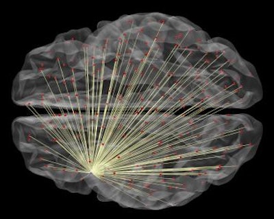 fMRI of neural connections