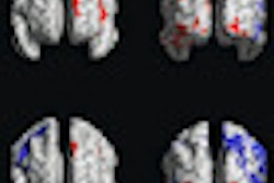 2012 08 13 13 30 06 574 Welker Leuko Thumb