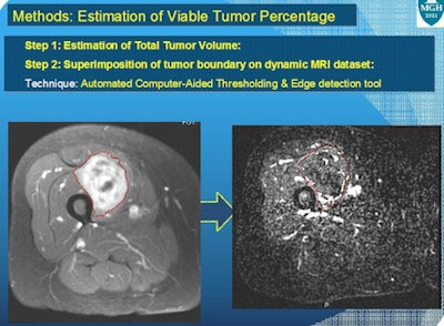 MGH software for estimating viable tumor