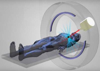 Geometry of the emission-guided radiation therapy system.
